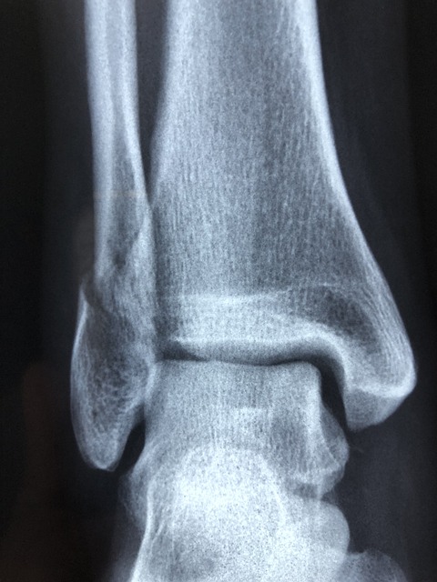 injury