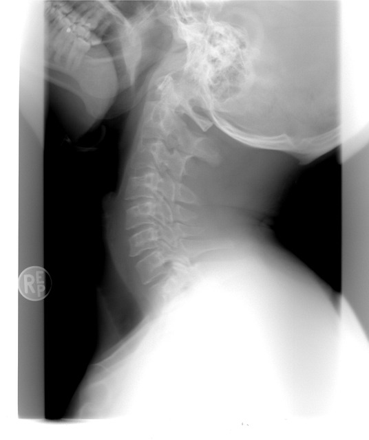 injury