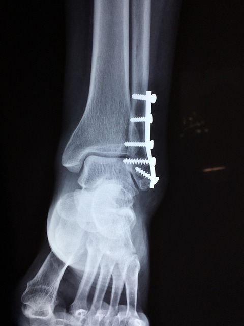 injury